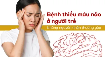 Bệnh thiếu máu não ở người trẻ: Những nguyên nhân thường gặp