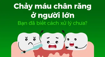 Chảy máu chân răng ở người lớn: Bạn đã biết cách xử lý chưa?
