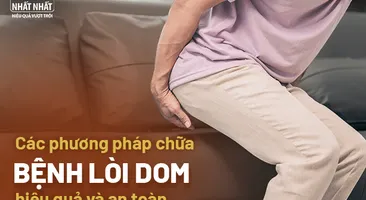 Các phương pháp chữa bệnh lòi dom hiệu quả và an toàn
