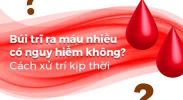 Búi trĩ ra máu nhiều có nguy hiểm không? Cách xử trí kịp thời