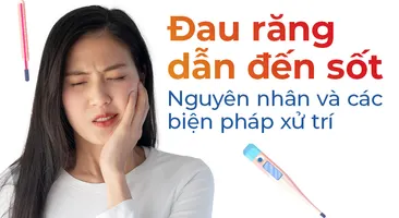 Đau răng dẫn đến sốt: Nguyên nhân và các biện pháp xử trí