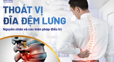 Thoát vị đĩa đệm lưng: Nguyên nhân và các biện pháp điều trị