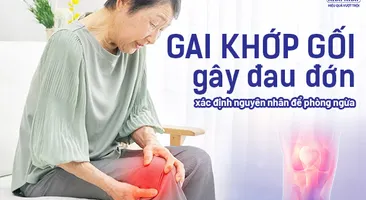 Gai khớp gối gây đau đớn: Cần xác định nguyên nhân để phòng ngừa