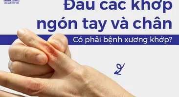 Đau các khớp ngón tay và chân: Có phải bệnh xương khớp?