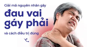 Giải mã nguyên nhân gây đau vai gáy phải và cách điều trị đúng 