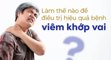 Làm thế nào để điều trị bệnh viêm khớp vai hiệu quả?