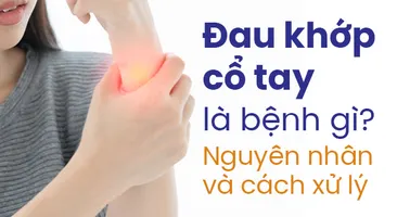 Đau khớp cổ tay là bệnh gì? Nguyên nhân và cách xử lý