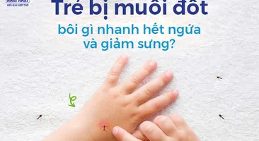 Trẻ bị muỗi đốt bôi gì nhanh hết ngứa và giảm sưng?