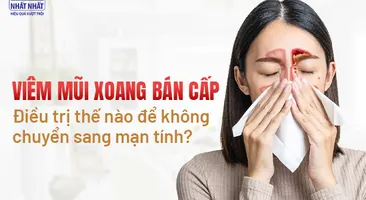 Viêm mũi xoang bán cấp: Điều trị thế nào để không chuyển sang mạn tính?