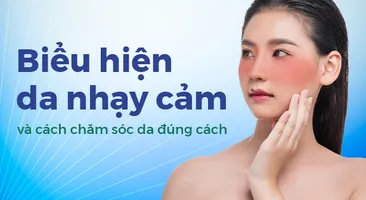 Biểu hiện da nhạy cảm và cách chăm sóc da đúng cách