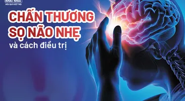 Nhận biết triệu chứng chấn thương sọ não nhẹ và cách điều trị