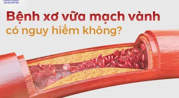 Tư vấn: Bệnh xơ vữa mạch vành có nguy hiểm không?