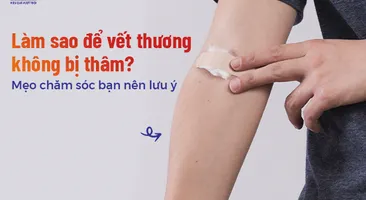 Làm sao để vết thương không bị thâm? Mẹo chăm sóc bạn nên lưu ý