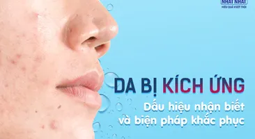 Da bị kích ứng: Dấu hiệu nhận biết và biện pháp khắc phục