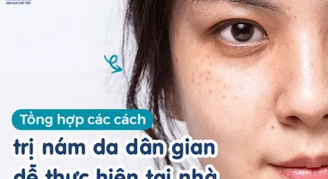 Tổng hợp các cách trị nám da dân gian dễ thực hiện tại nhà 