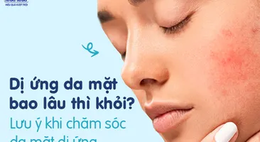 Dị ứng da mặt bao lâu thì khỏi? Những lưu ý khi chăm sóc da mặt dị ứng