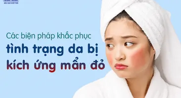 Các biện pháp khắc phục tình trạng da bị kích ứng mẩn đỏ