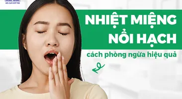 Nhiệt miệng nổi hạch: Chỉ dẫn cách phòng ngừa hiệu quả cao