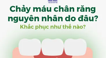 Chảy máu chân răng nguyên nhân do đâu? Khắc phục như thế nào?