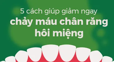 5 cách giúp giảm ngay chảy máu chân răng hôi miệng