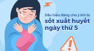 Dấu hiệu đáng chú ý khi bị sốt xuất huyết ngày thứ 5