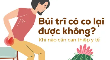 Búi trĩ có co lại được không? Khi nào cần can thiệp y tế
