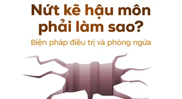 Nứt kẽ hậu môn phải làm sao? Biện pháp điều trị và phòng ngừa
