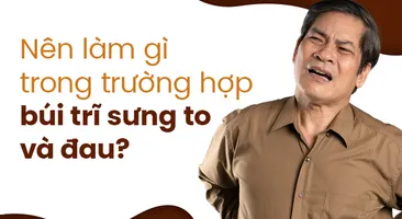 Nên làm gì trong trường hợp búi trĩ sưng to và đau?