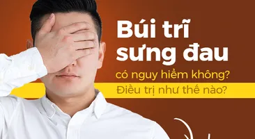 Búi trĩ sưng đau có nguy hiểm không? Điều trị như thế nào?