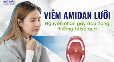 Viêm amidan lưỡi: Nguyên nhân gây đau họng thường bị bỏ qua
