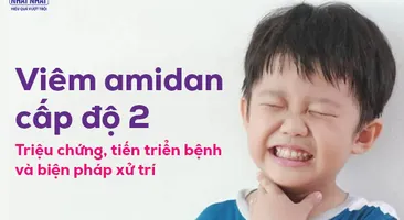 Viêm amidan cấp độ 2: Triệu chứng, tiến triển bệnh và biện pháp xử trí