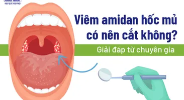 Viêm amidan hốc mủ có nên cắt không: Giải đáp từ chuyên gia