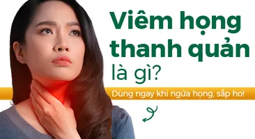 Viêm họng thanh quản là gì: Dùng ngay khi ngứa họng, sắp ho! 