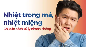 Nhiệt trong má, nhiệt miệng: Chỉ dẫn cách xử lý nhanh chóng