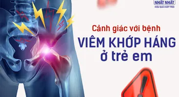 Cảnh giác với bệnh viêm khớp háng ở trẻ em