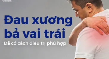 Đau xương bả vai trái: Đã có cách điều trị phù hợp