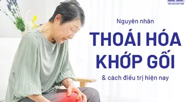 Nguyên nhân thoái hóa khớp gối và cách điều trị hiện nay