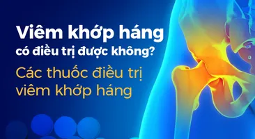 Viêm khớp háng có điều trị được không: Thuốc điều trị viêm khớp háng