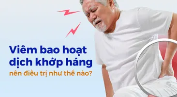 Viêm bao hoạt dịch khớp háng nên điều trị như thế nào?