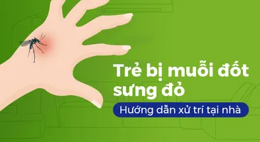 Trẻ bị muỗi đốt sưng đỏ: Hướng dẫn xử trí tại nhà