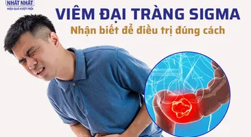 Viêm đại tràng sigma: Nhận biết để điều trị đúng cách