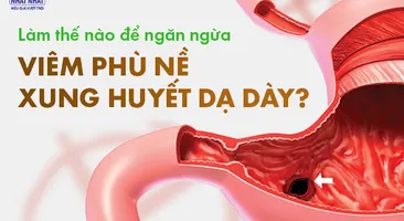 Làm thế nào để ngăn ngừa viêm phù nề xung huyết dạ dày?