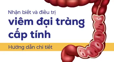 Nhận biết và điều trị viêm đại tràng cấp tính: Hướng dẫn chi tiết