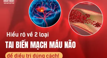 Hiểu rõ về 2 loại tai biến mạch máu não để điều trị đúng cách!