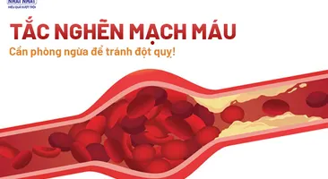 Tắc nghẽn mạch máu – Cần phòng ngừa để tránh đột quỵ!