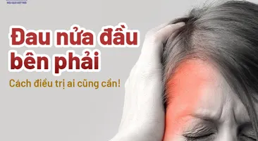 Đau nửa đầu bên phải: Cách điều trị ai cũng cần! 