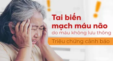 Tai biến mạch máu não do máu không lưu thông: Triệu chứng cảnh báo