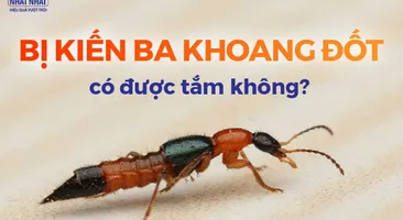 Tư vấn: Bị kiến ba khoang đốt có được tắm không? 
