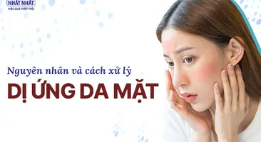 Nguyên nhân và cách xử lý dị ứng da mặt an toàn