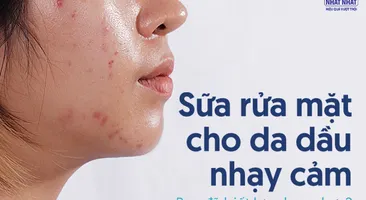 Sữa rửa mặt cho da dầu nhạy cảm: Bạn đã biết lựa chọn chưa?
